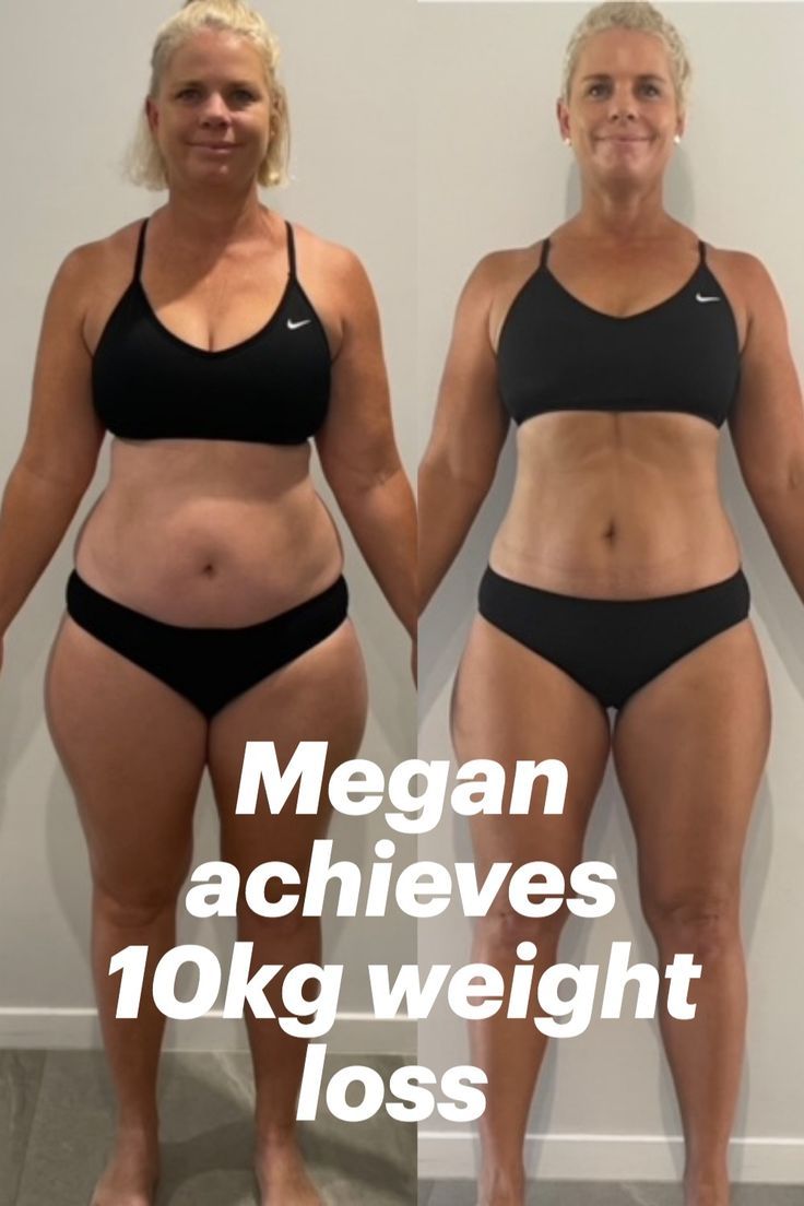 Two side-by-side images show the front view of a woman in black sports bra and shorts before and after using MATXI GO DETOX HERBAL WEIGHT LOSS, achieving a 10kg weight loss. Text: "Megan achieves 10kg weight loss. Buy MATXI GO DETOX HERBAL WEIGHT LOSS at MyAllures.