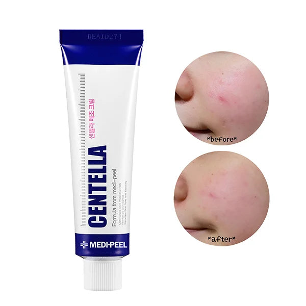 Image of a skincare product tube labeled "MEDIPEEL CENTELLA MEZZO CREAM" next to text highlighting key ingredients: Centella Asiatica for soothing, Aloe Barbadensis Leaf Extract for moisturizing, and Allantoin for skin protection. Buy at MyAllures for radiant, healthy skin.