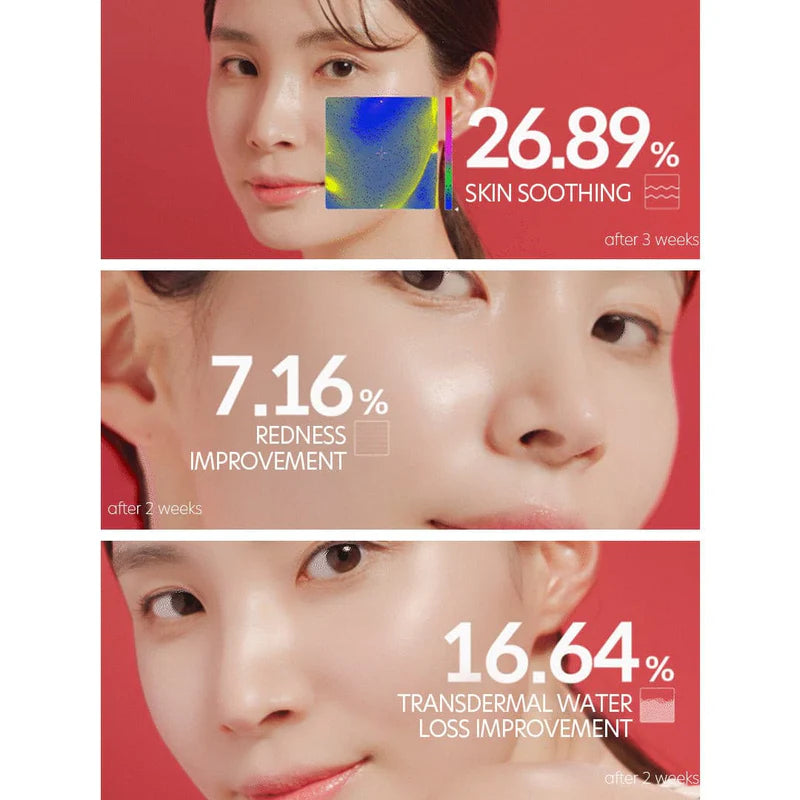 Images of a woman's face showing different skincare improvements after using DALBA VITAL SPRAY SERUM by DALBA. Numerical results include: 26.89% skin soothing (after 3 weeks), 7.16% redness improvement (after 2 weeks), and a 16.64% improvement in transdermal water loss. Buy at MyAllures for transformative results!