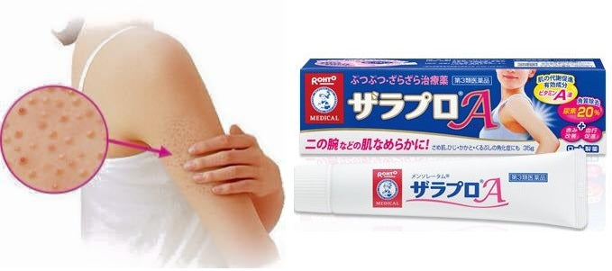 ROHTO MENTHOLATUM ZARAPRO FOR SCALY SKIN - MyAllures 